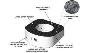 TyWedge System